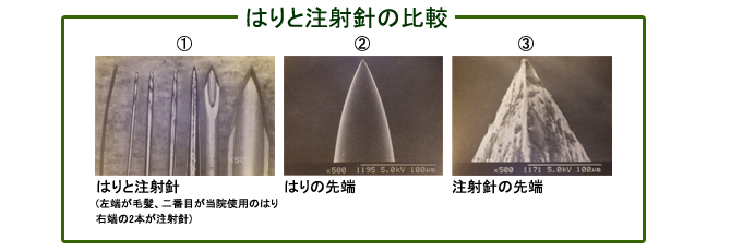 はりと注射針の比較:台東区のマッサージ・整体　ぎっくり腰、はり、骨盤矯正なら　森の治療院